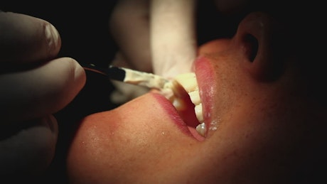 Dental surgery, close up.
