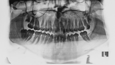 Dental x-ray.