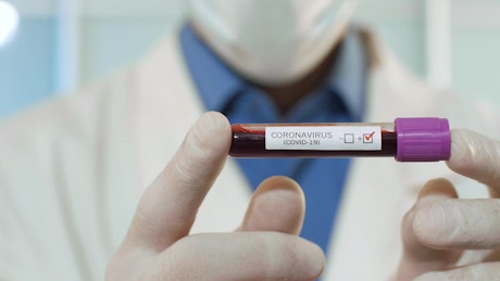 Doctor holding a blood sample with coronavirus.
