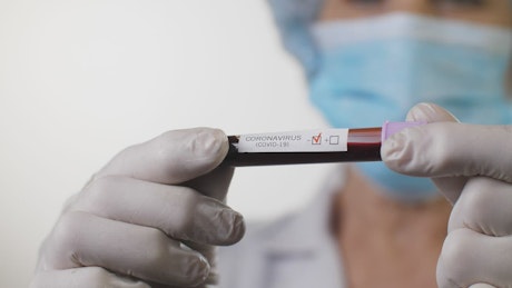 Doctor holding a Covid-19 blood test.