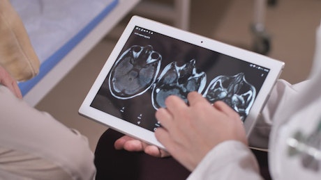 Doctor showing scan results on a tablet.