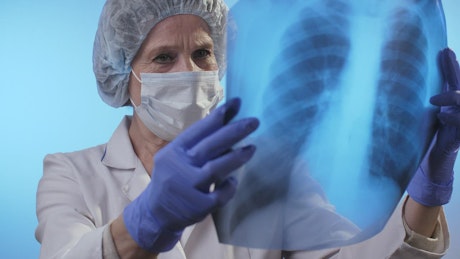 Female doctor looking at an x-ray of lungs.