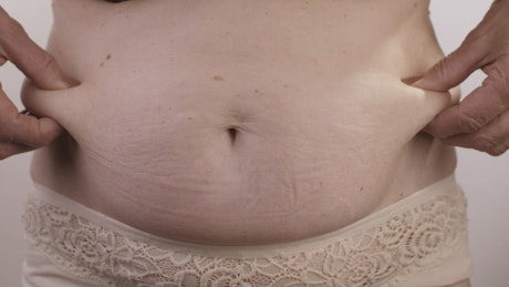 Obese person touching his stomach.