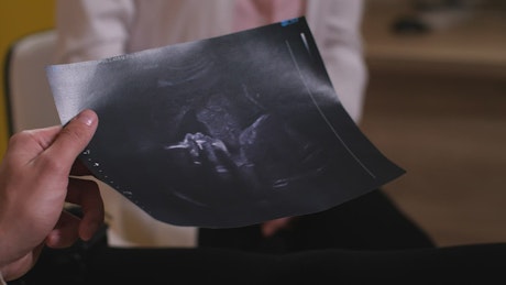 Parents holding an ultrasound photo.